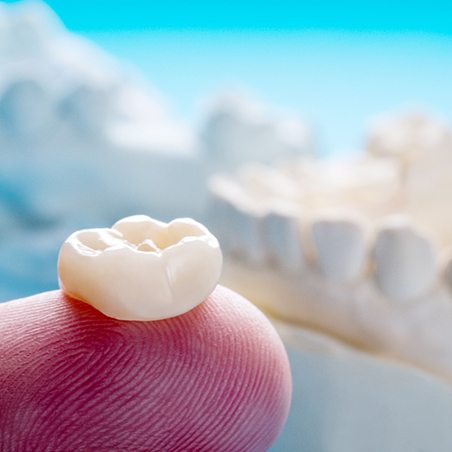 A close-up of a dental crown on a person’s finger