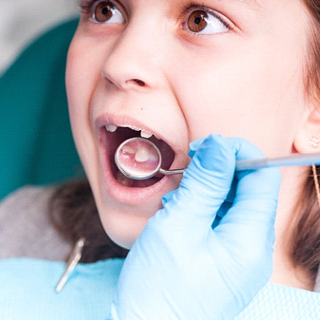 Dentist determining dental sealants in Wylie